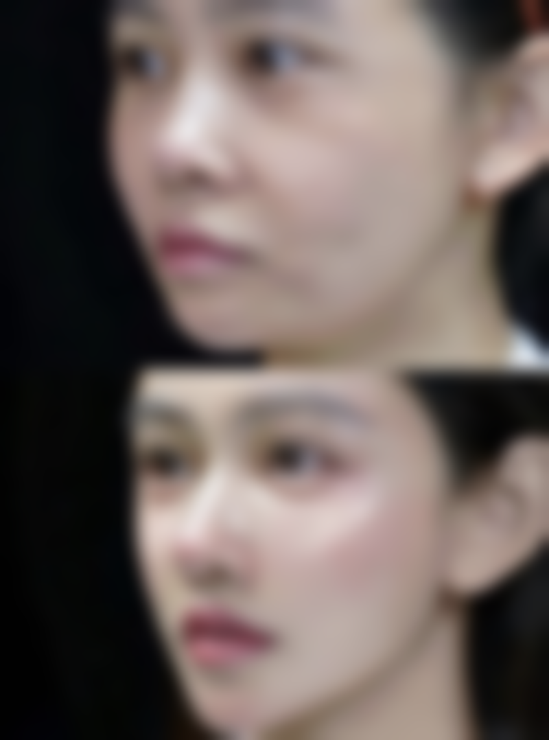 如何降低手术风险