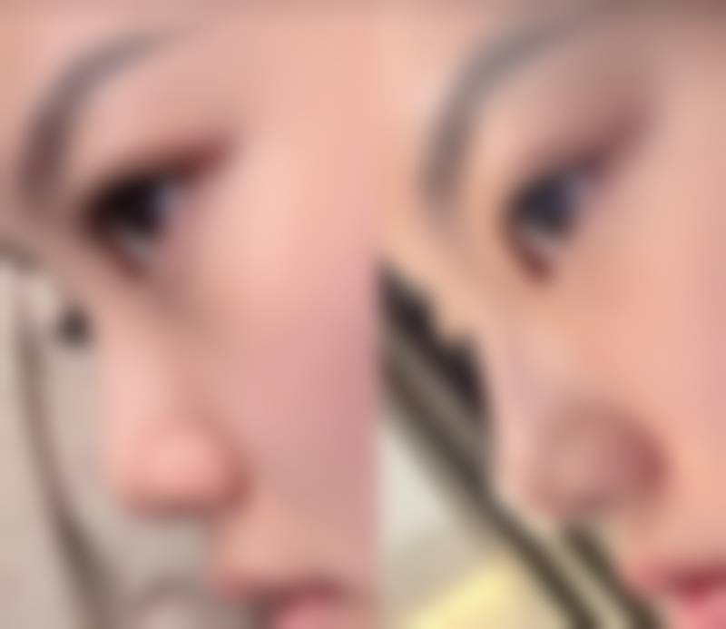 【凯里芳娴医疗美容诊所是正规的吗?】