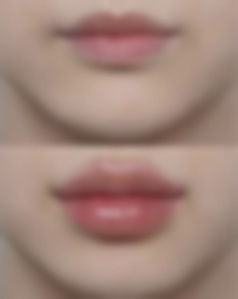 喷雾去皱纹的副作用