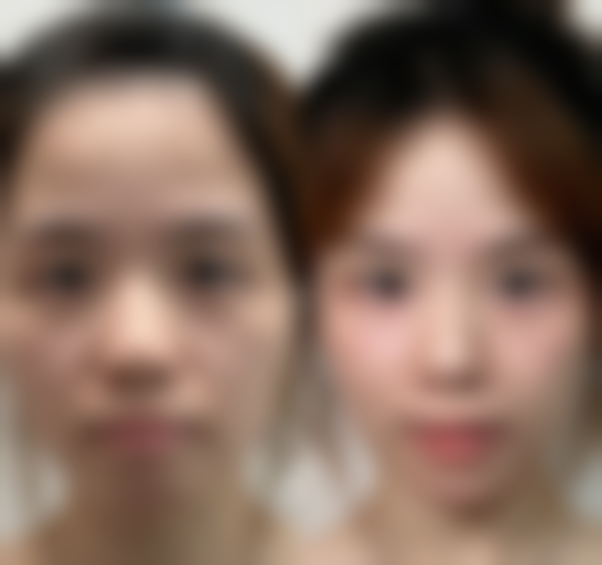 【王凤波医生技术特点】