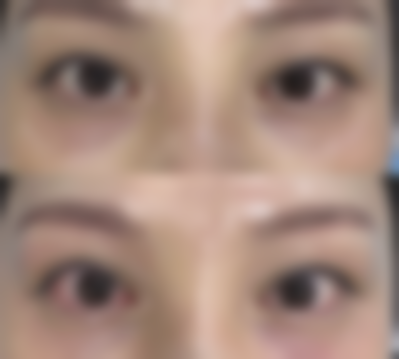 【吕春红医生擅长项目】