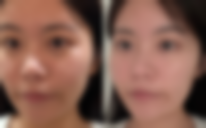 【上海百达丽医疗美容医院是正规的吗?】