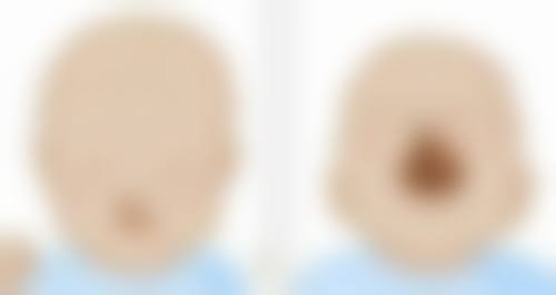 服用消炎药前的注意事项