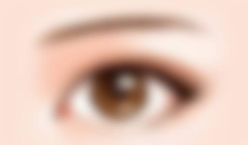 打除皱针打成了肿眼泡怎么办？