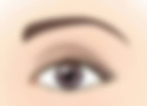 唇组织缺损不超过全唇的1/3处理方法