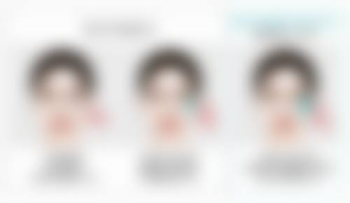 瘦脸针什么牌子更好更安心