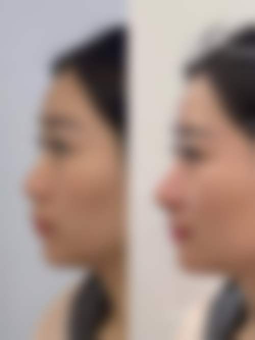 【杨志波医生怎么预约挂号?】