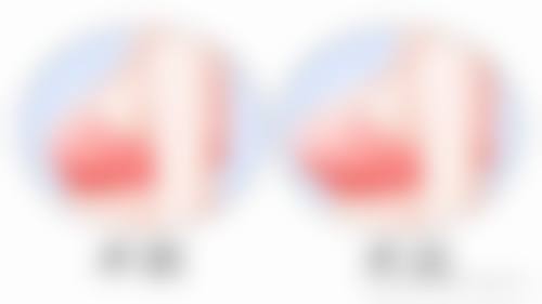 【林禹蓁医生擅长项目】