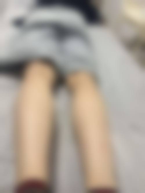 【赵江茹医生擅长项目】