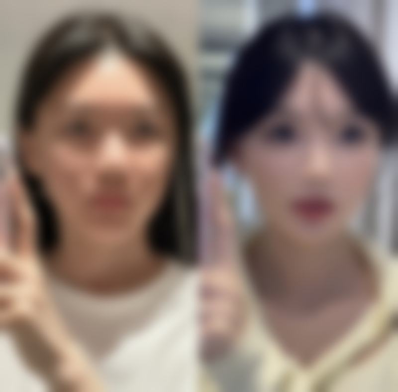 打瘦脸针一周后可以吃消炎药吗女性