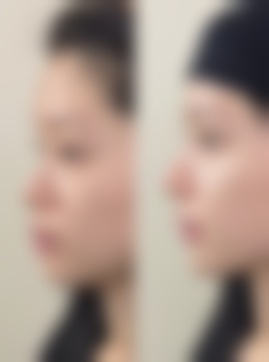 【王凤波医生怎么预约挂号?】