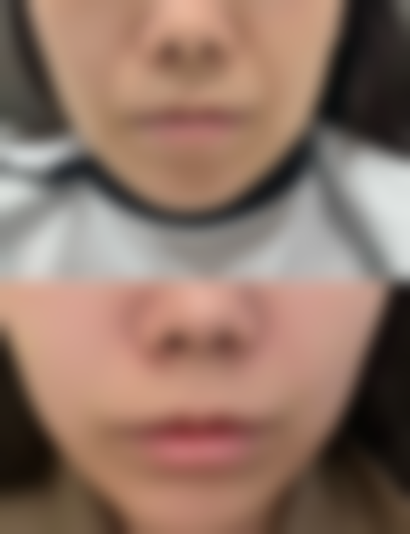 【广州婕熹卡医疗美容门诊部诊疗设备:】