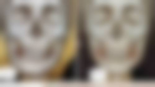 一般下腹、会阴部手术 术后第几天拆线