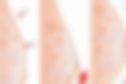 【上海俪人整形美容医院患者口碑评价:】