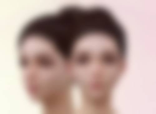 快速的FUE植发技术