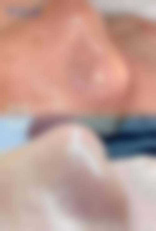 【田松医生技术特点:】