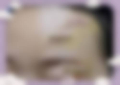 【济宁星坊整形美容医院患者口碑评价:】