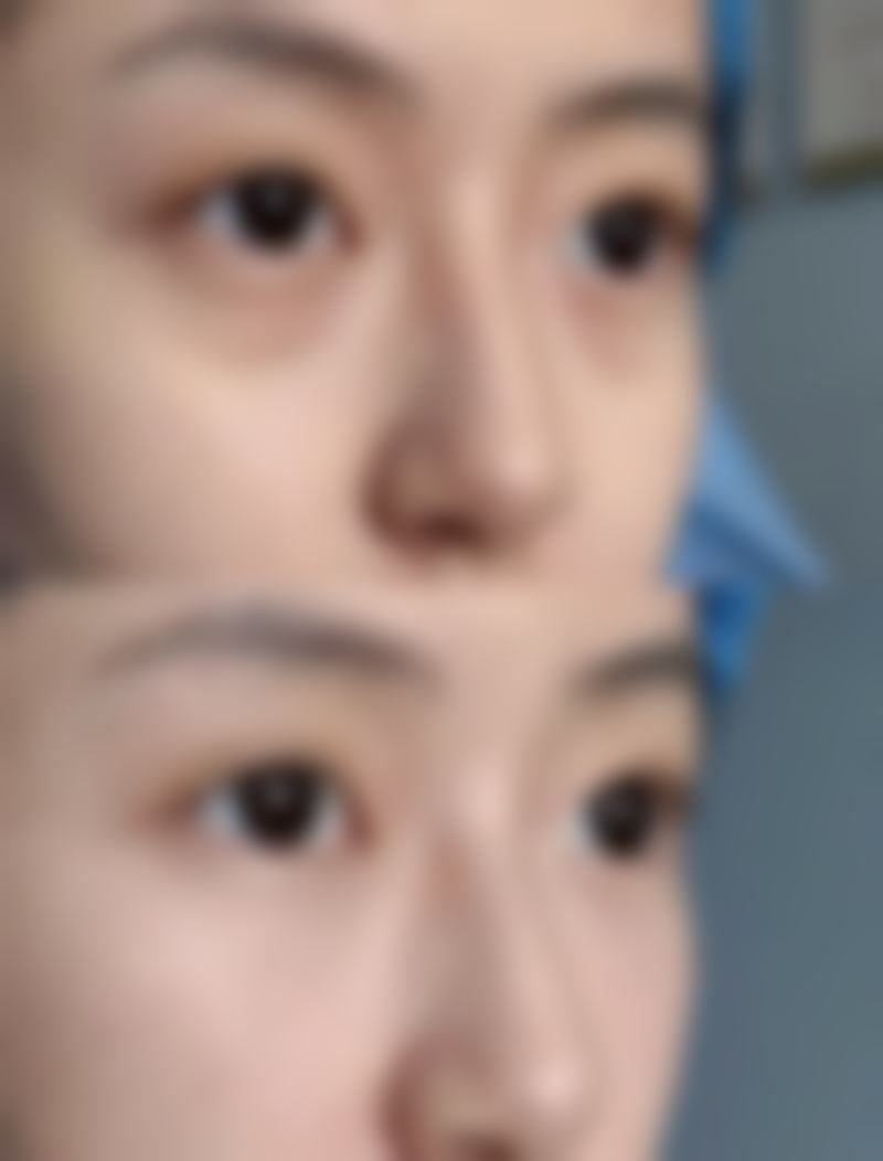 【延安大学咸阳医院医疗美容科怎么预约挂号?】