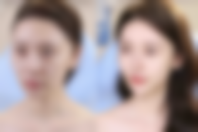 【林禹蓁医生擅长项目】