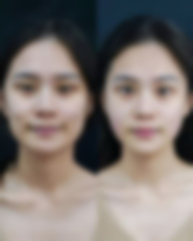 【南通沈美医疗美容诊所特色项目:】