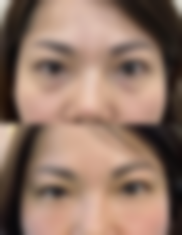 【 石家庄凤凰医院私密整形科医生名单:】