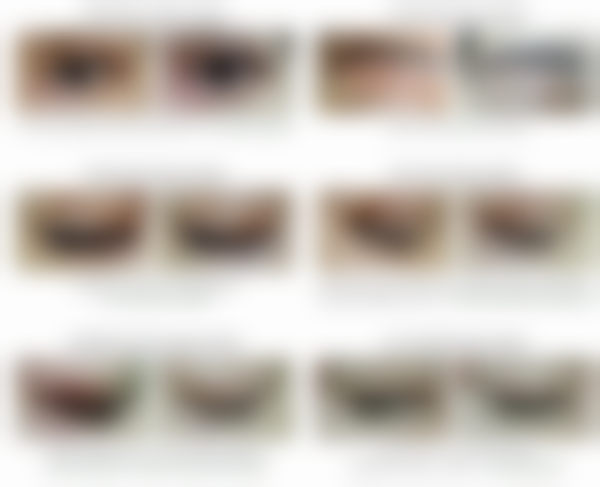 以下是韩国思亲肤乐疤痕管理中 心部分项目的参考价格表（价格仅供参考，实际以到院面诊为准）：