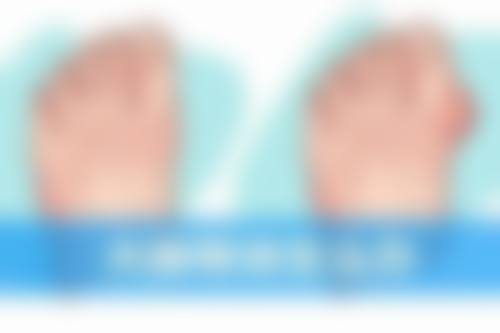 50岁女性能打瘦脸针吗？