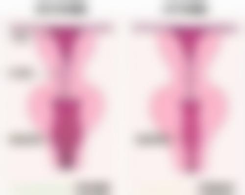 打完瘦脸针能怀孕吗有影响吗？揭秘打瘦脸针后怀孕的潜在风险与科学备孕的 3 大关键要点！ 