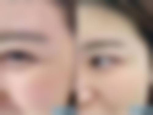 打完瘦脸针能怀孕吗有影响吗