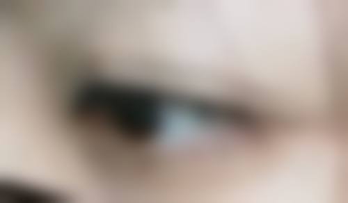 关于种植发的常见疑问解答