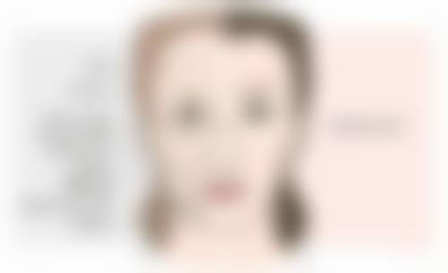 种植发是怎么种的？揭秘植发全过程，5 大步骤让你清楚了解，还能知晓术后效果与护理要点！ 