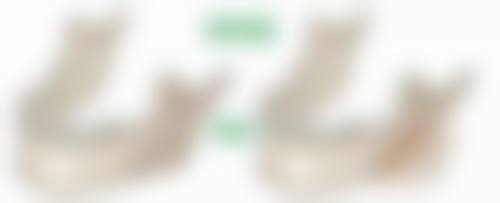 拉皮术除皱有什么不好