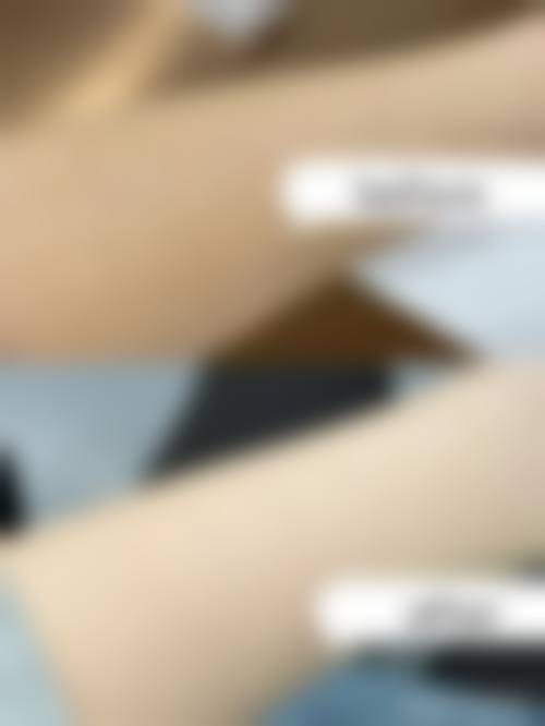 【赵江茹医生擅长项目】