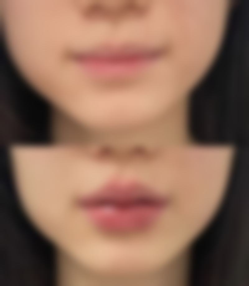 【孙同医生擅长项目】