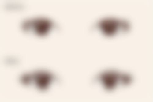 包茎矫正凝胶剂有用吗？权威解析其原理与效果，超 80%使用者反馈有效改善包茎问题！ 