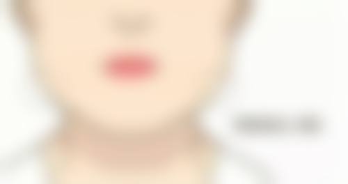 国产瘦脸针品牌十大排行榜