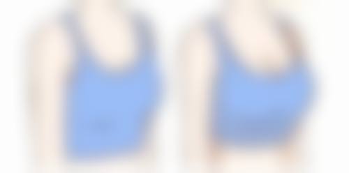 面部除皱热玛吉好吗？揭秘热玛吉4大除皱优势，精准抗衰激活肌肤活力，让你年轻5岁不是梦！ 