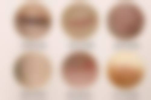 欣德美玻尿酸适合打哪些部位呢？