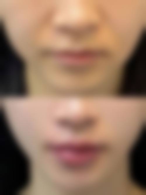 【昆明陆庭芳医疗美容诊所患者口碑评价：】