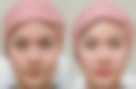 【张家港熙贝缇医疗美容诊所地址:】