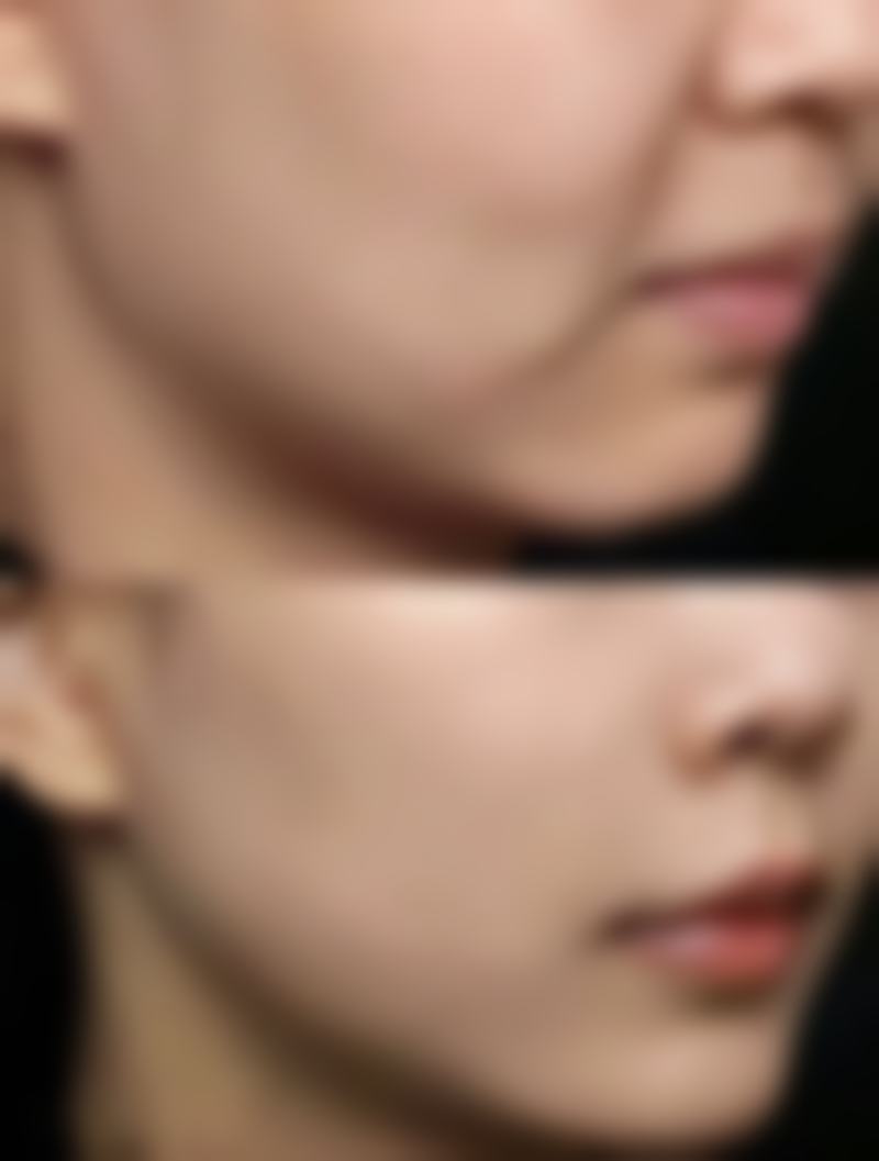 【乌兰浩特艺禾医疗美容门诊部患者口碑评价:】