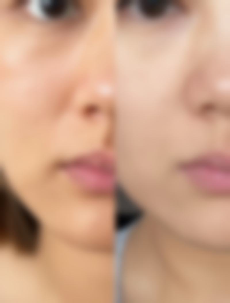 【广州樱美医疗美容门诊部（原广州颜所医疗美容门诊部）是正规的吗?】