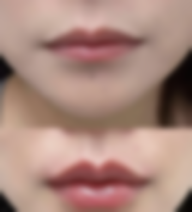 风靡女性的瘦脸针,作用原理是什么?潜在风险有哪些?