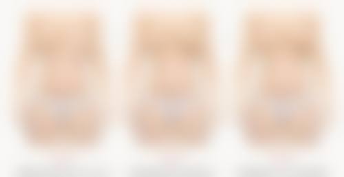 头发可以再种植吗？揭秘2024医美植发新技术，95%成活率让你告别脱发困扰重拾浓密秀发！ 