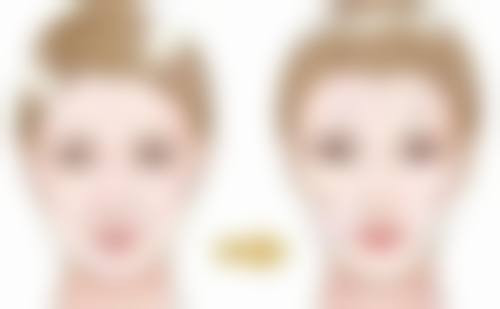 种植头发大概多少钱