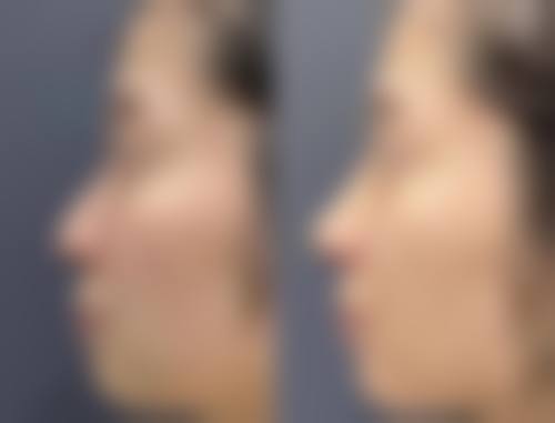 来例假能种睫毛和染头发吗?