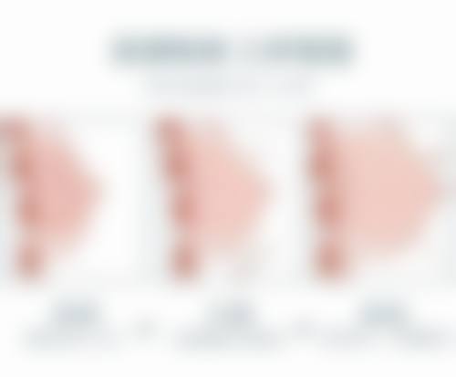 下巴和脖子连在一起怎么整形？揭秘3种热门医美方案，让你轻松拥有清晰颈颌线，重拾年轻自信！ 