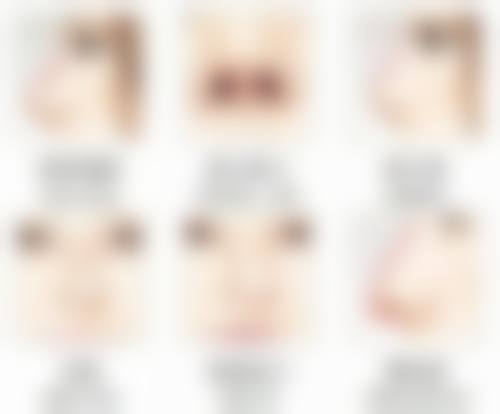 月经期与非月经期植发风险对比