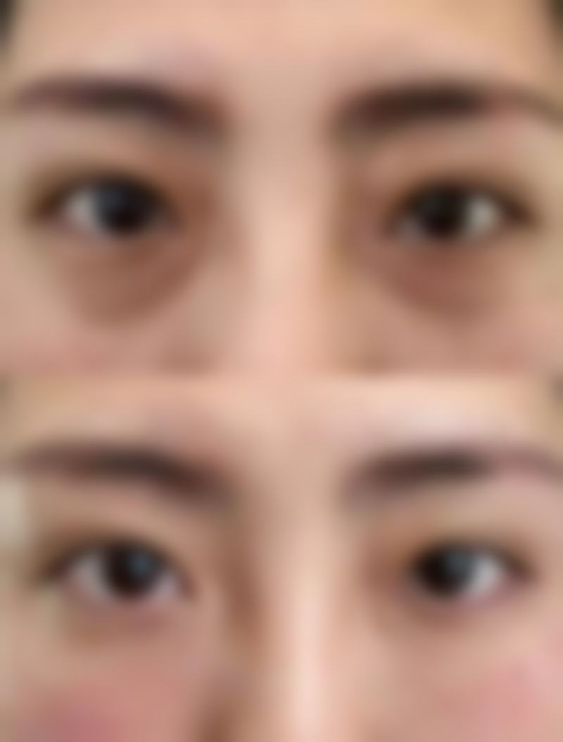 嘴唇有点向外凸怎么矫正