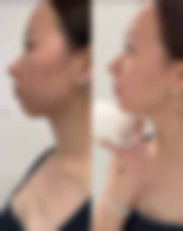 【西安俪人医院医疗美容科是正规的吗?】